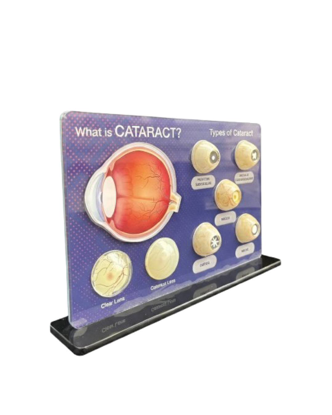 Cataract_Counselling_Tool_1