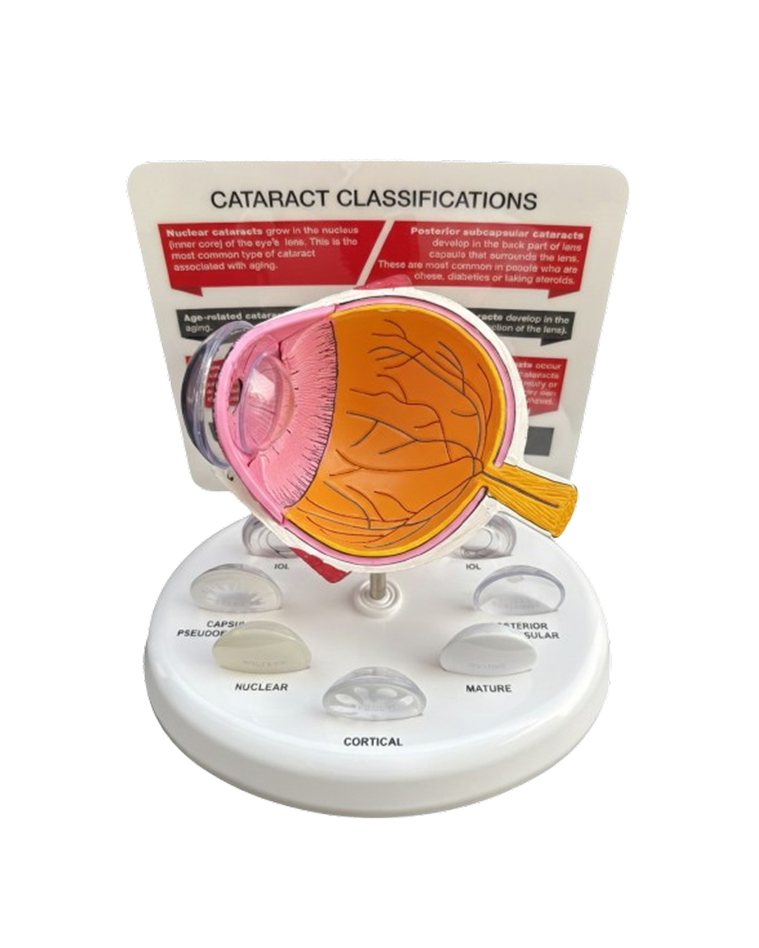 Cataract_Eye_Model_2