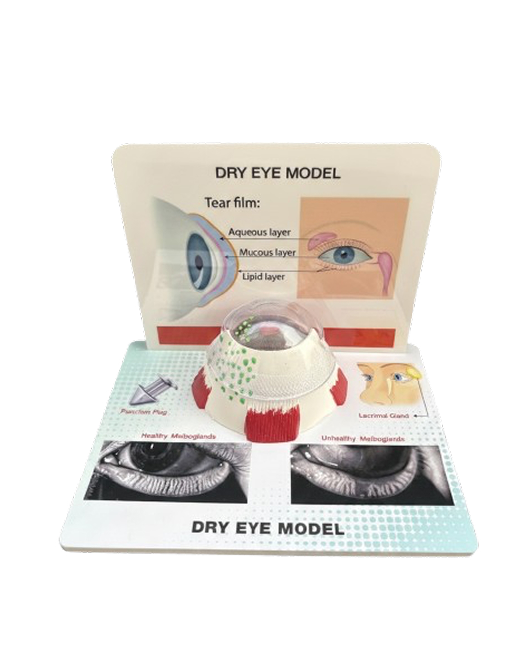 Dry_Eye_Model