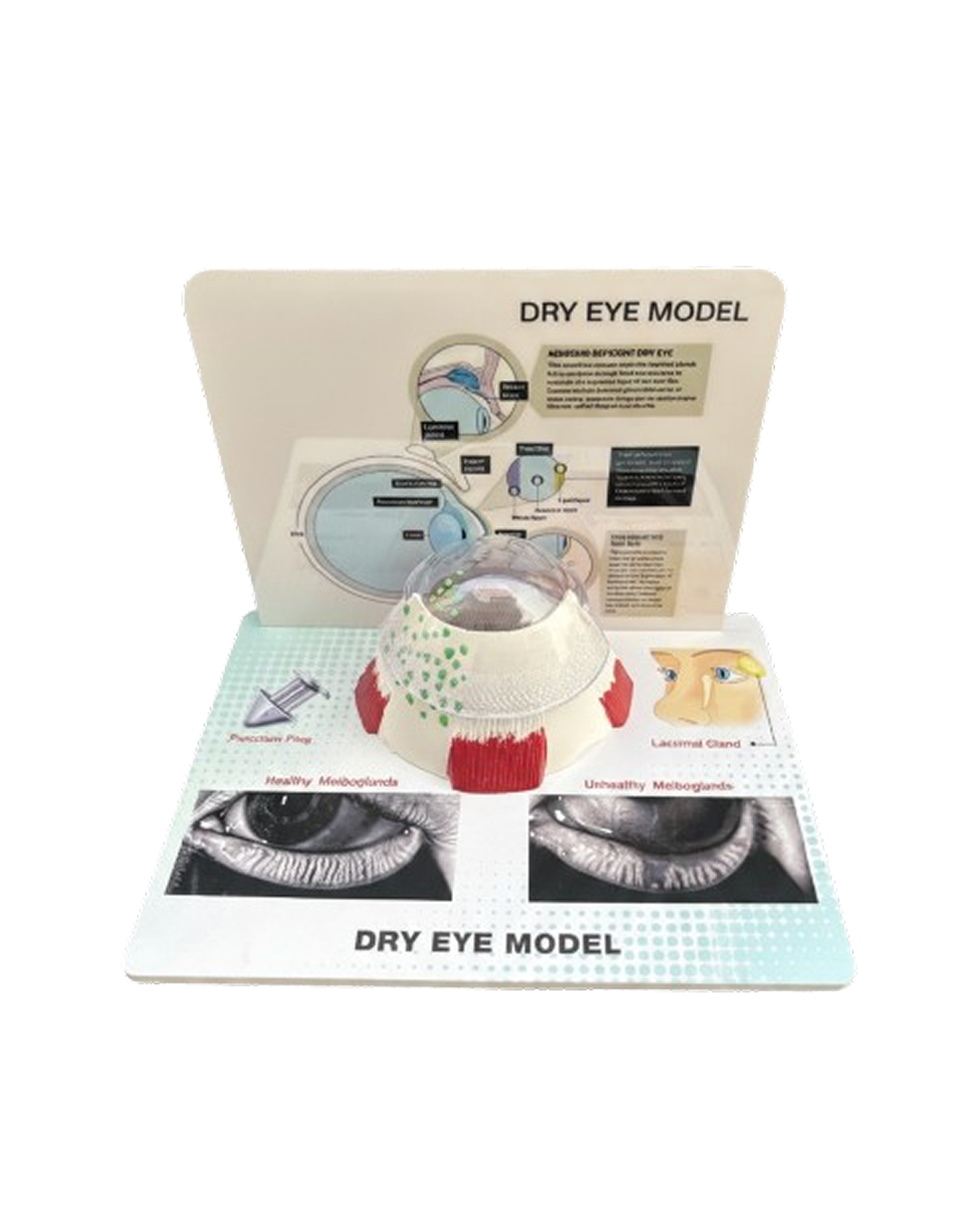 Dry_Eye_Model_1