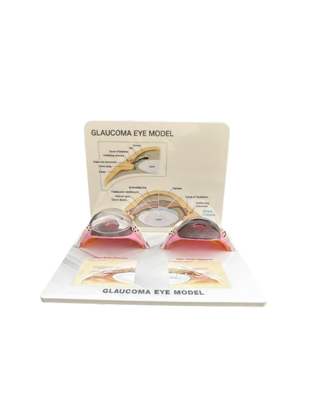 Glaucoma_Eye_Model