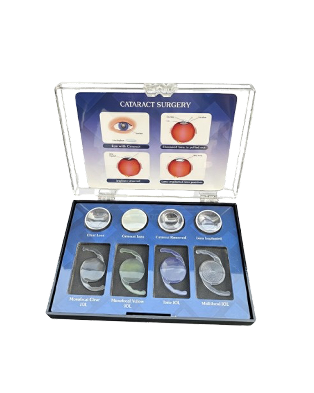 IOL_Counselling_Kit_2