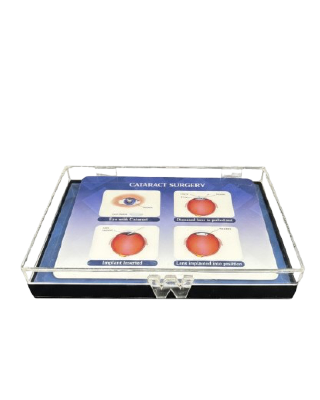 IOL_Counselling_Kit_3