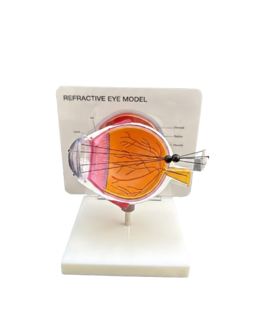 Refractive_Errors_Eye_Model