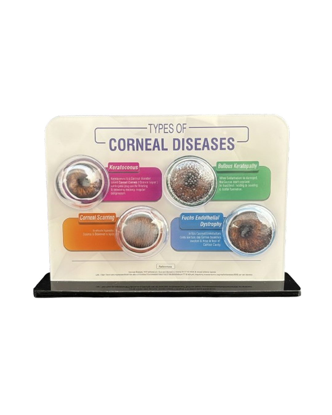 Layers_of_Cornea_Model_1