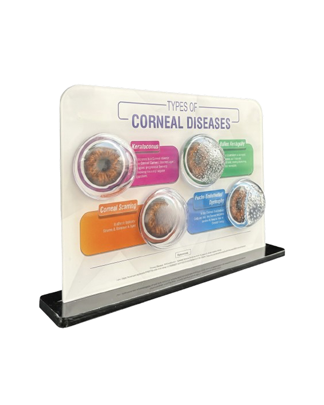 Layers_of_Cornea_Model_2