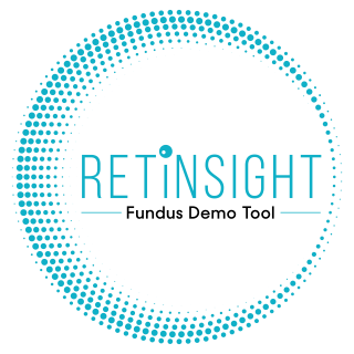 RetinSight logo mobile